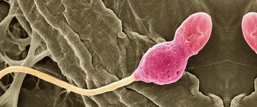 How To Make Sperm Stronger For Pregnancy Info