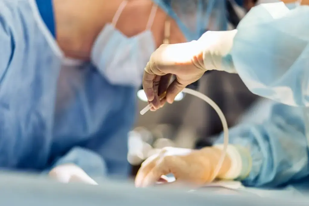 AUG 22261 image 3 LIV Hospital