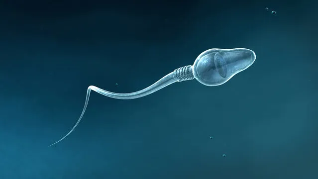 3 Types Of Sperm defects: Best Vital Facts