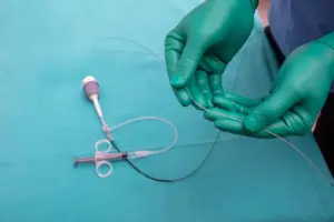 Angioplasty Vs Stent: Best Vital Guides