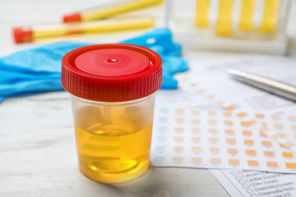 Urinalysis Test: Best Child Health Guide