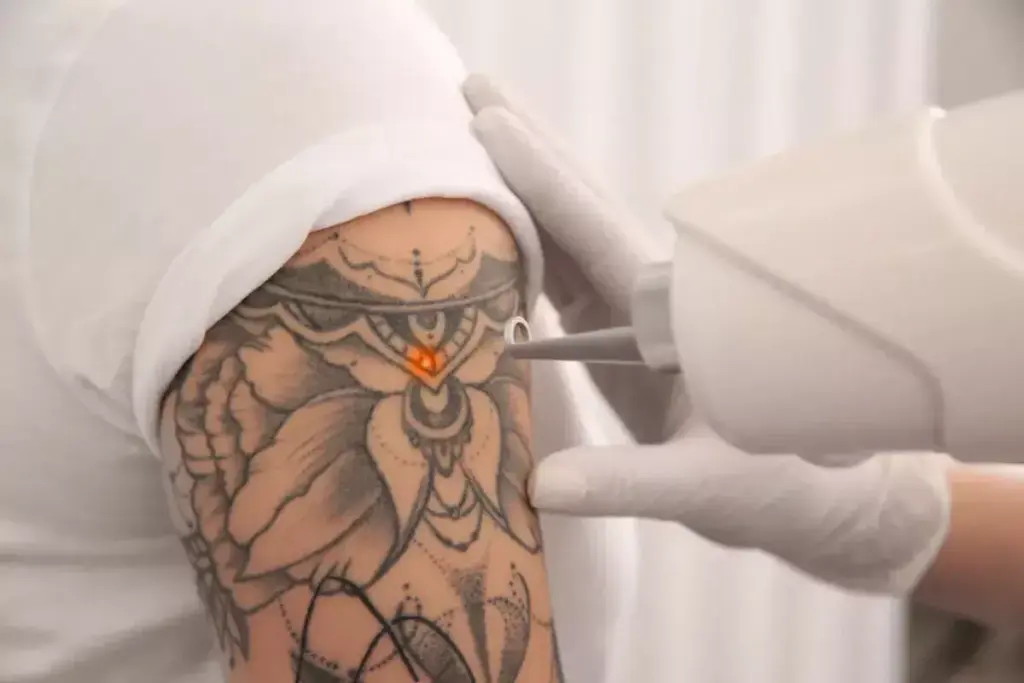 How to Remove Temporary Tattoos Off Skin