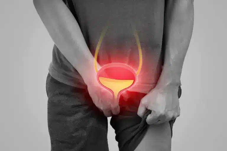 Inflammation Of Urethra: Best Vital Facts