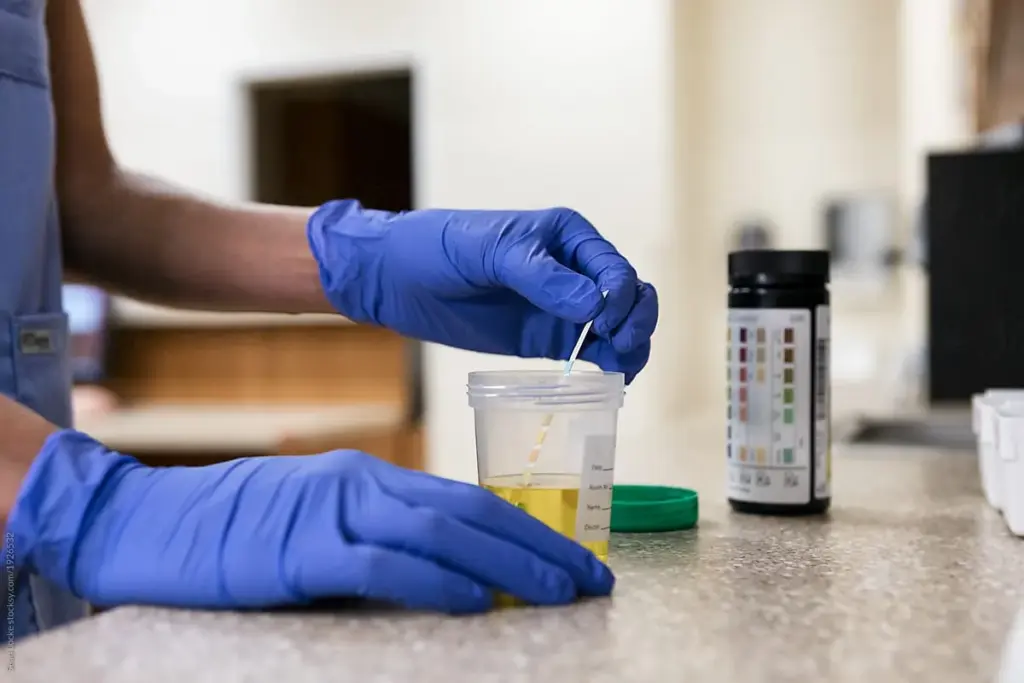 What Tests Urine Sample? Best Accurate Info