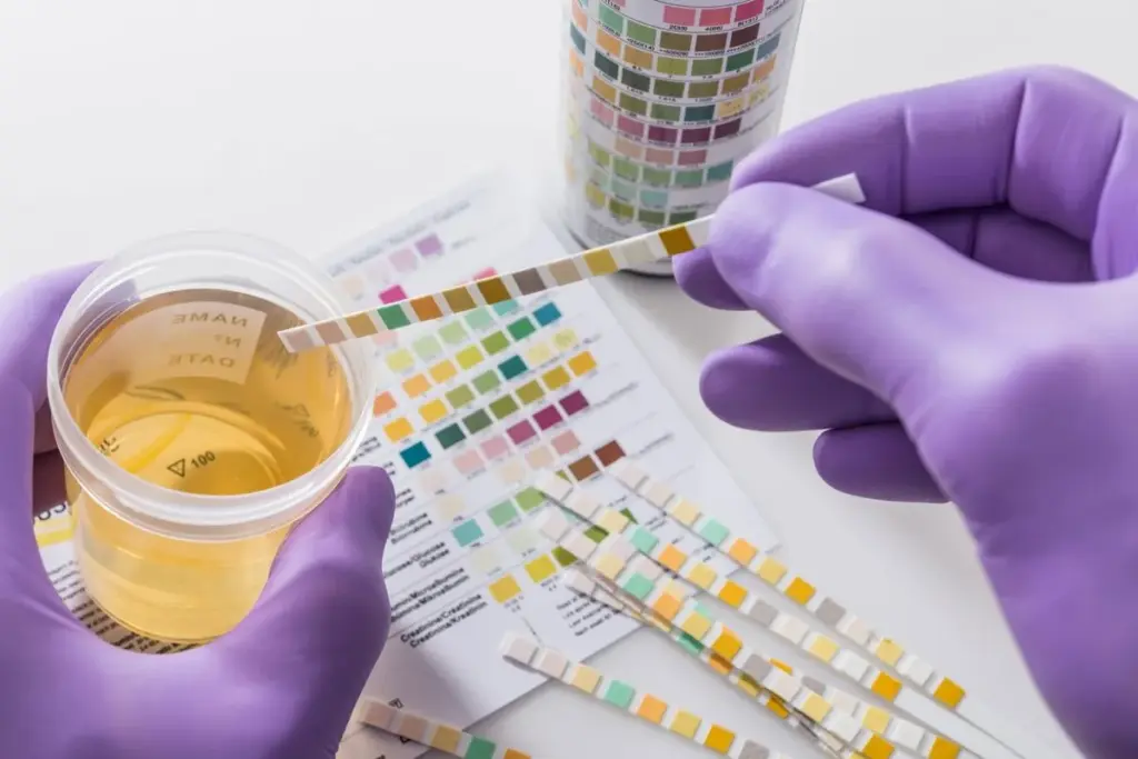 What Tests Urine Sample? Best Accurate Info