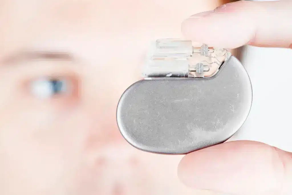 Pacemaker Restrictions: Best Safety Guide Info