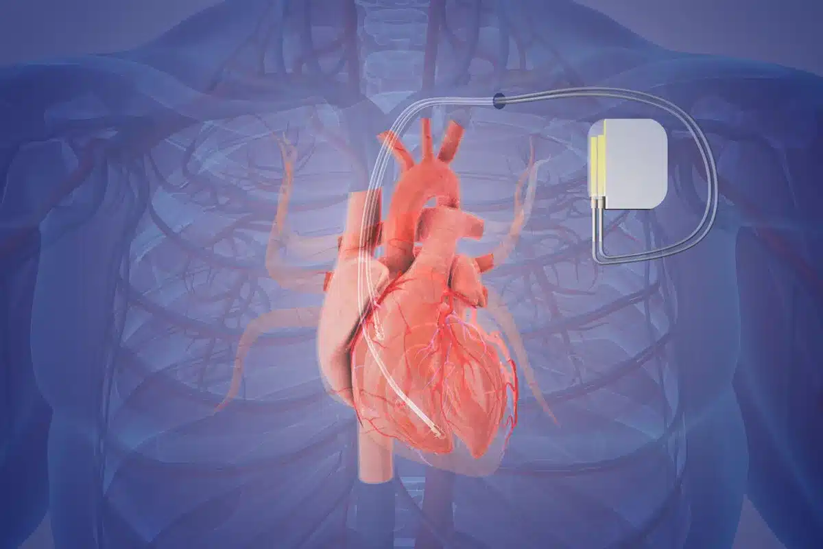 Heart Catheterization Procedure: No Pain?