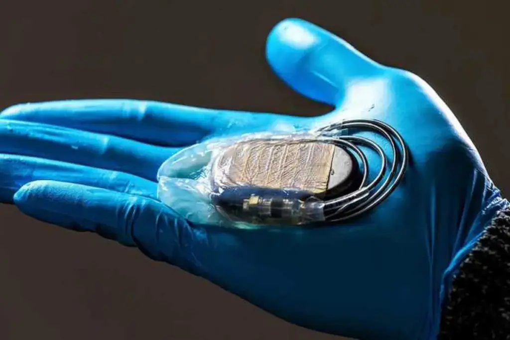 Saline Pool Swim: Best Pacemaker Safety Tips 3 Saline Pool Swim: Best Pacemaker Safety Tips