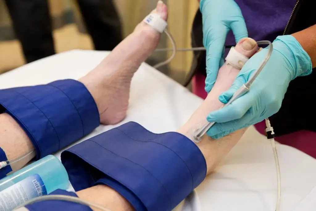 Do Angioplasty With Stenting Need Leg Straight? 1 Do Angioplasty With Stenting Need Leg Straight?