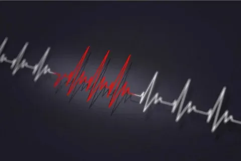 Arrhythmia Cure: Best Natural Rhythm Tips