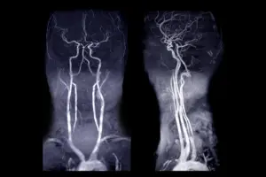 Coronary Angiography: Avoid Bad Errors