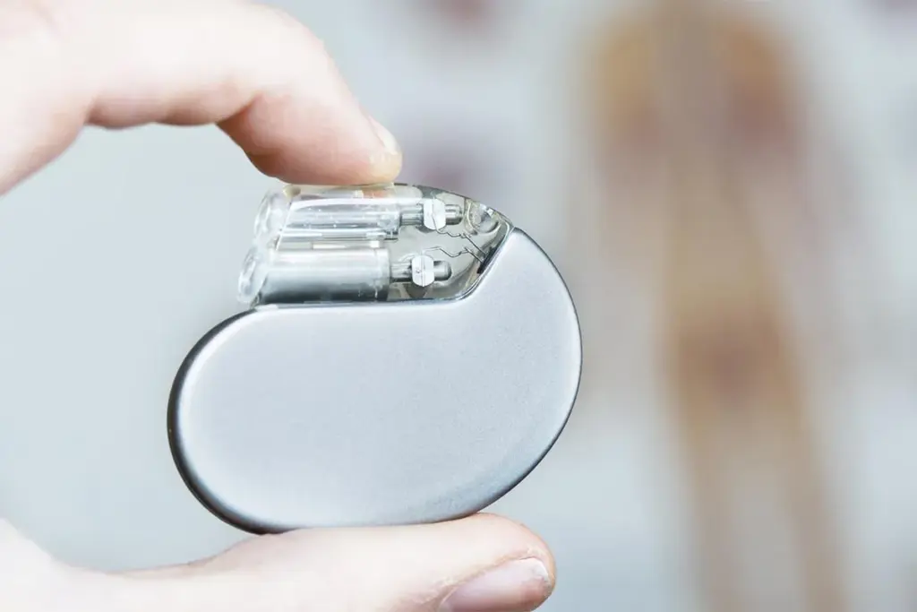 Things You Can't Do With A Pacemaker: Fly Safe 2 Things You Can't Do With A Pacemaker: Fly Safe