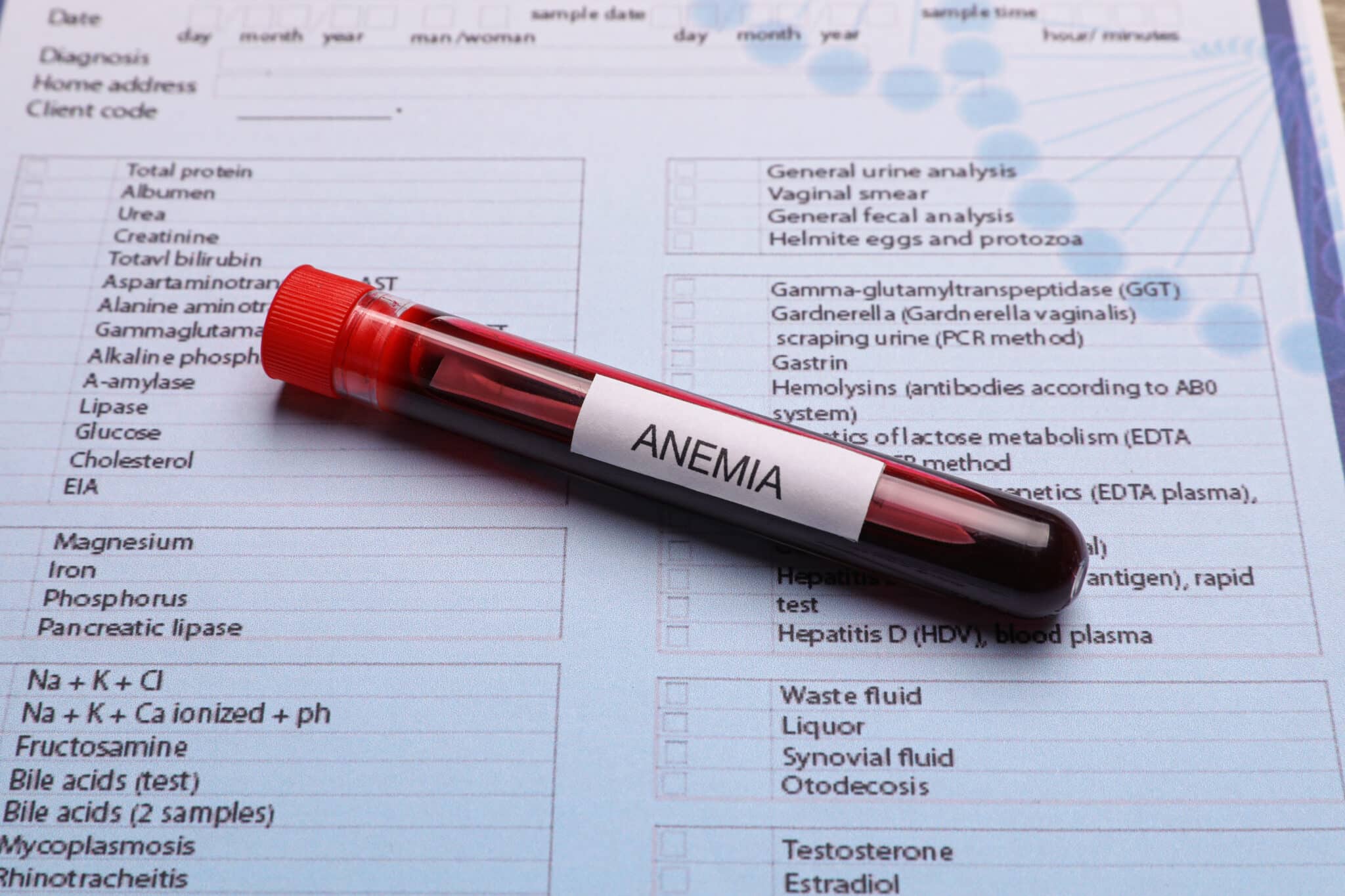 Anemia in Kidney Disease: Symptoms and Causes