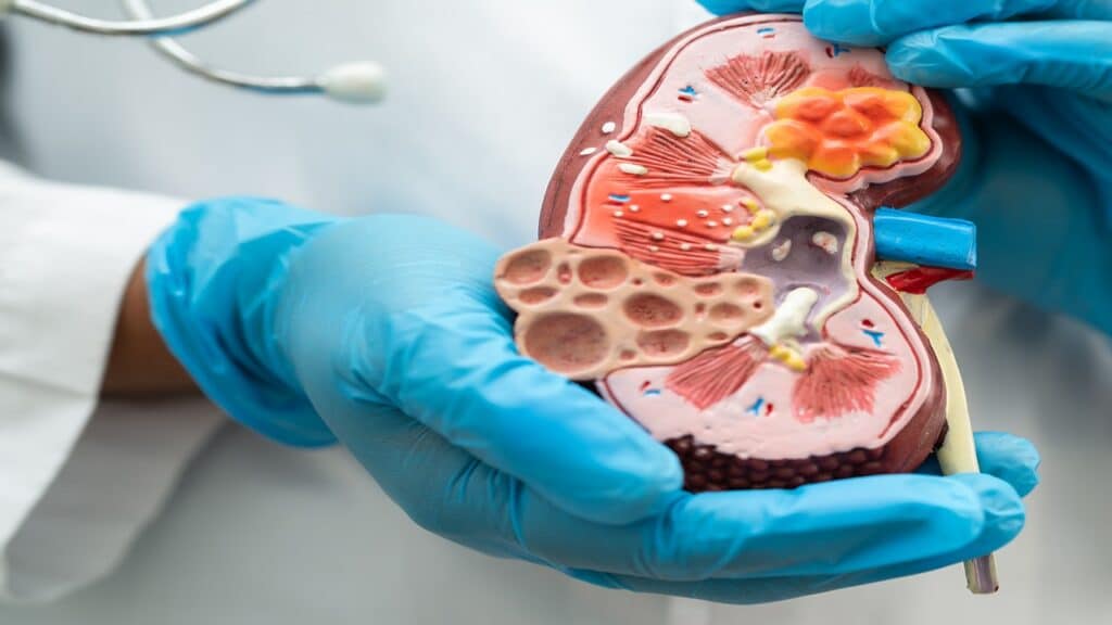 Amyloidosis and the Kidney