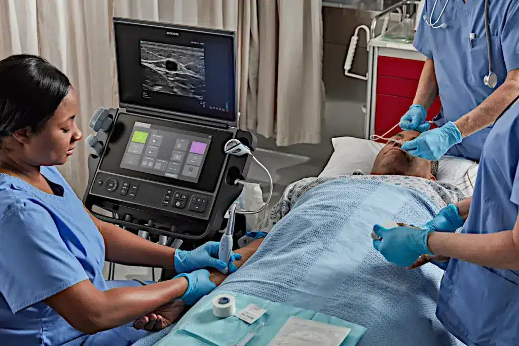 IVUS Ultrasound Vs Angiography: Facts