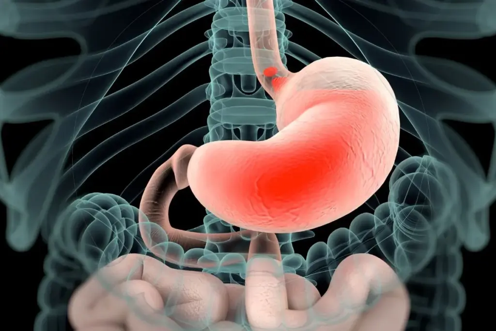 Angiogram Fasting: Best Safe Prep Tips 2 image 2 2282 LIV Hospital