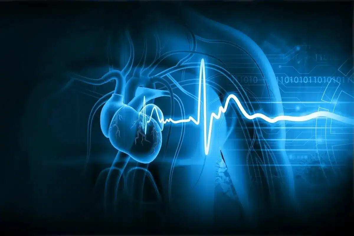 how long does a heart cath take