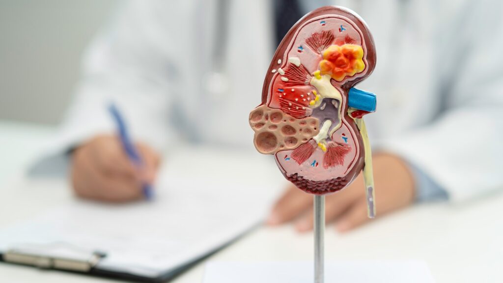 kidney disease chronic kidney disease ckd doctor with human model study treat hospital yt thumbnail 1280 720 1 LIV Hospital