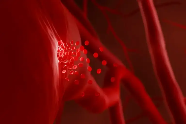 Sharp How Long Uterine Fibroid Embolization?