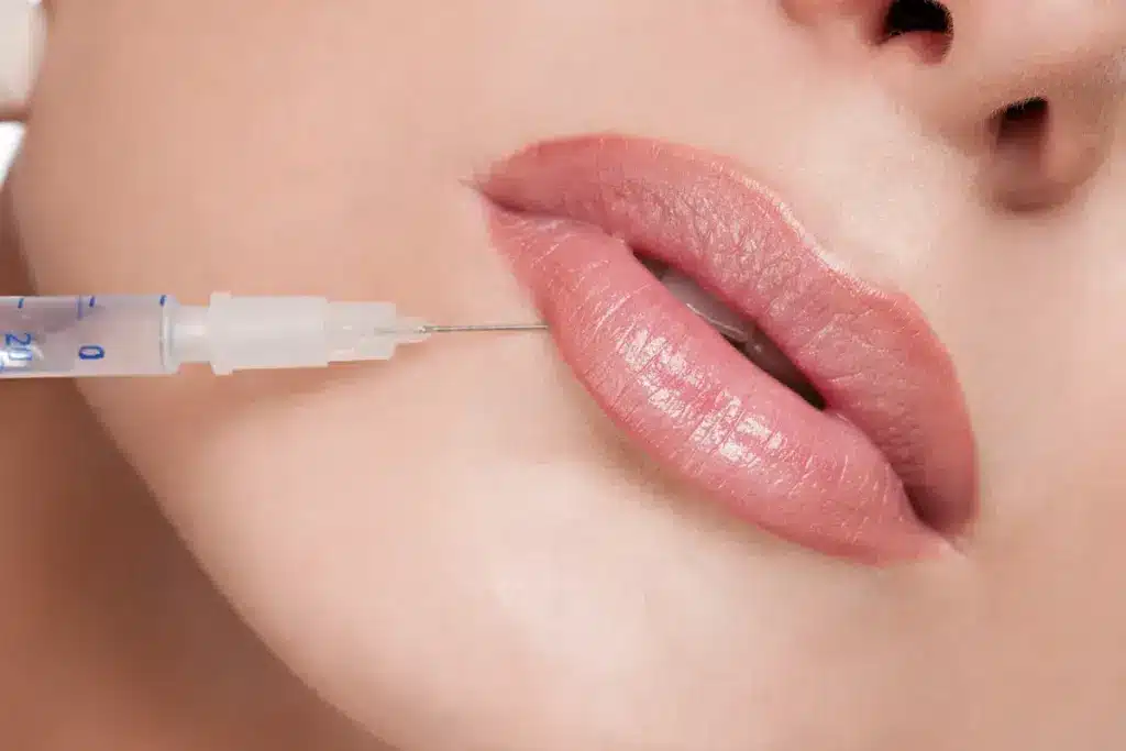 Guide Can You Microneedle Your Lips (Microneedling Lips)?