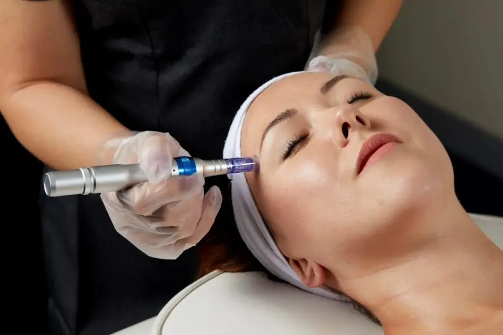 Essential How Often Should You Micro Needling (Micro Needling)?