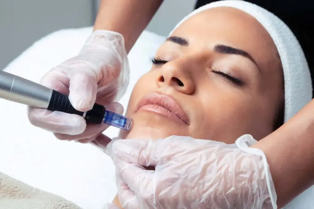 Simple Is There Anything Better Than Microneedling (Fractional Laser Resurfacing)?