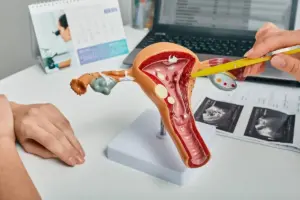 Insightful What Happens Untreated Uterine Fibroids?