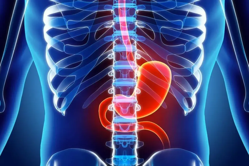Amazing What To Expect After Liver Radioembolization (Radioembolization Recovery)?