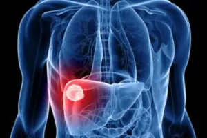 Essential What Does Y-90 Decay To (Y90 Decay)?