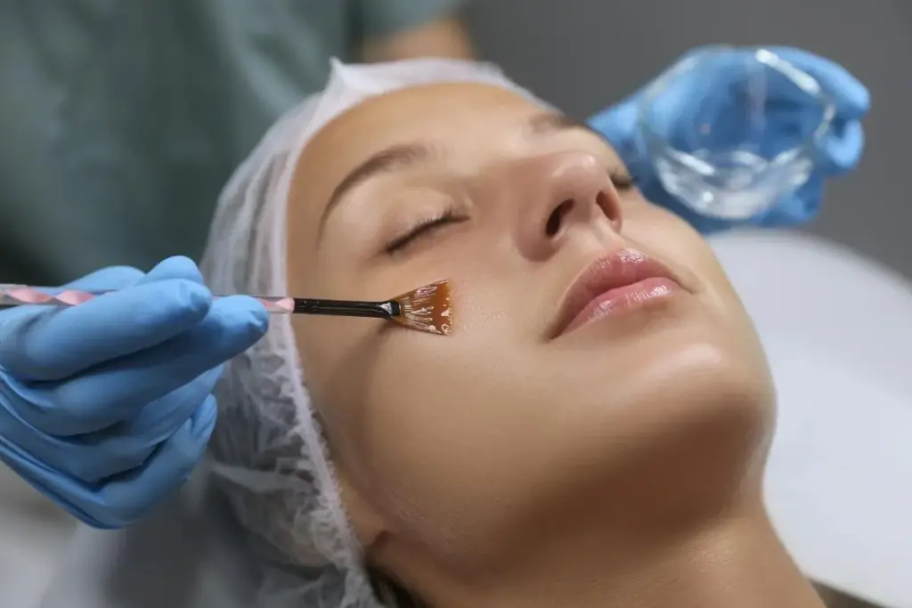 Insightful Can I Get Laser After A Chemical Peel: Laser And Chemical Peel Together