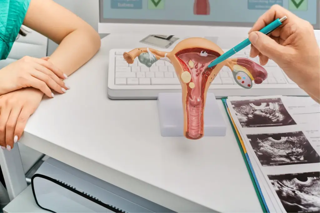 Amazing Is It Better To Shrink Or Remove Fibroids (Shrink Vs Remove Fibroids)? 3 image 3 1880 LIV Hospital