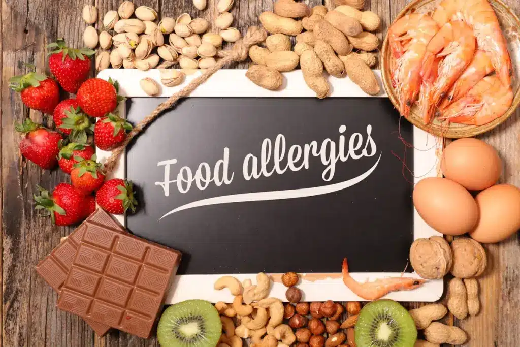 Valuable What Foods Should You Avoid If You Have Allergic Rhinitis?
