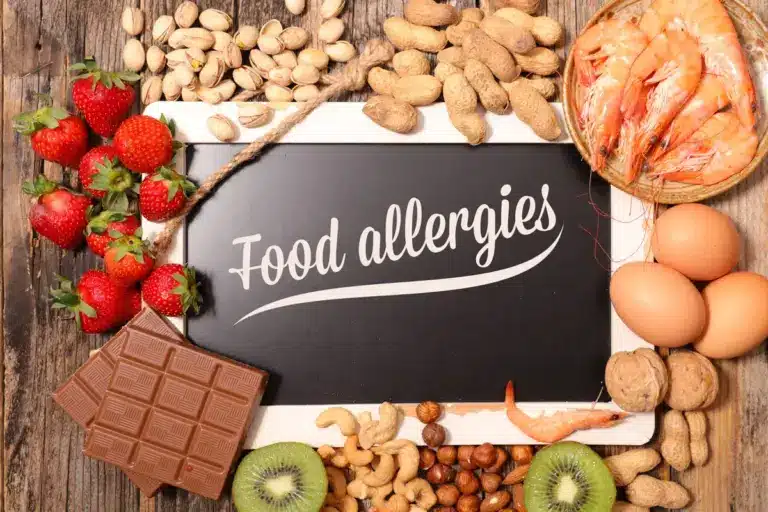 Valuable What Foods Should You Avoid If You Have Allergic Rhinitis?