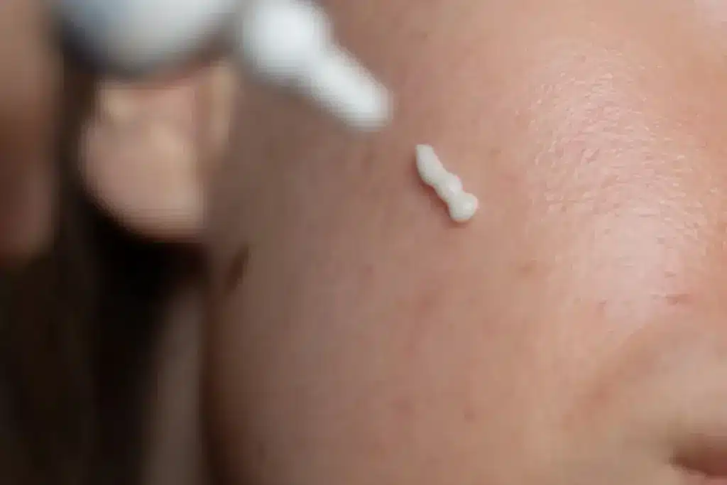 Key Is Tretinoin Better Than Retinol (Tretinoin)?