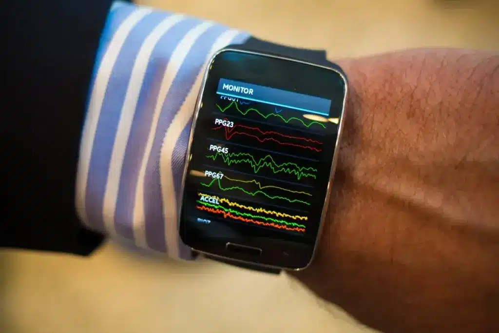 ECG Apple Watch: Best Accuracy Insights