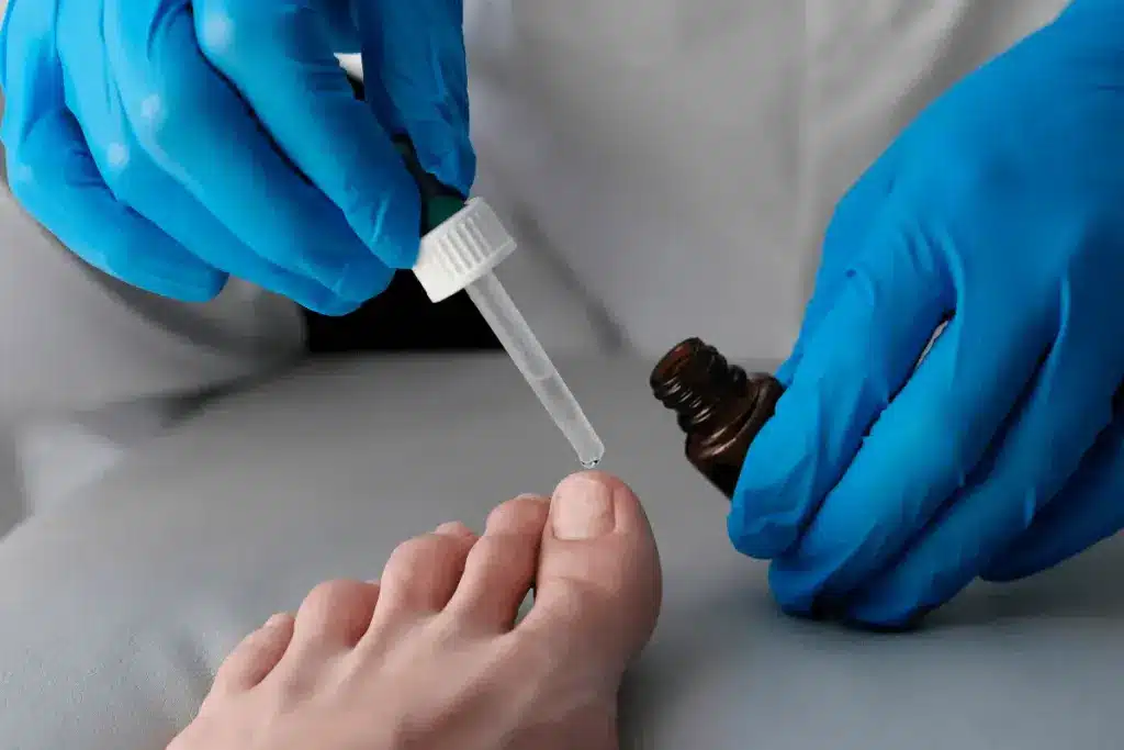 Essential Does Vinegar Stop Fungus (Vinegar Vinegar Vinegar)? 1 Essential Does Vinegar Stop Fungus (Vinegar Vinegar Vinegar)?