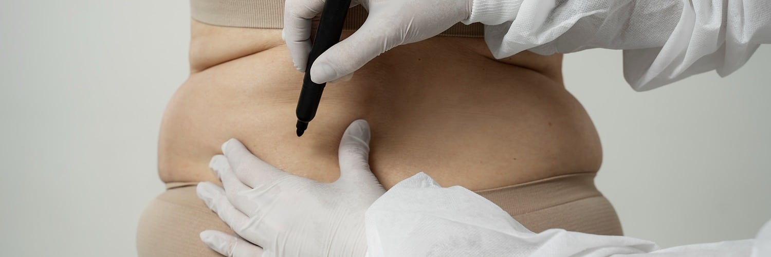 back view hands with gloves drawing with marker x banner 1500 500 LIV Hospital