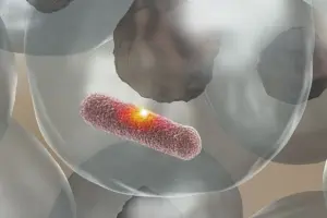 Crucial What Mimics Allergic Rhinitis (Allergic Rhinitis Mimics)?