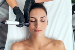 Simple Can I Microneedle A Scar (Microneedling)?