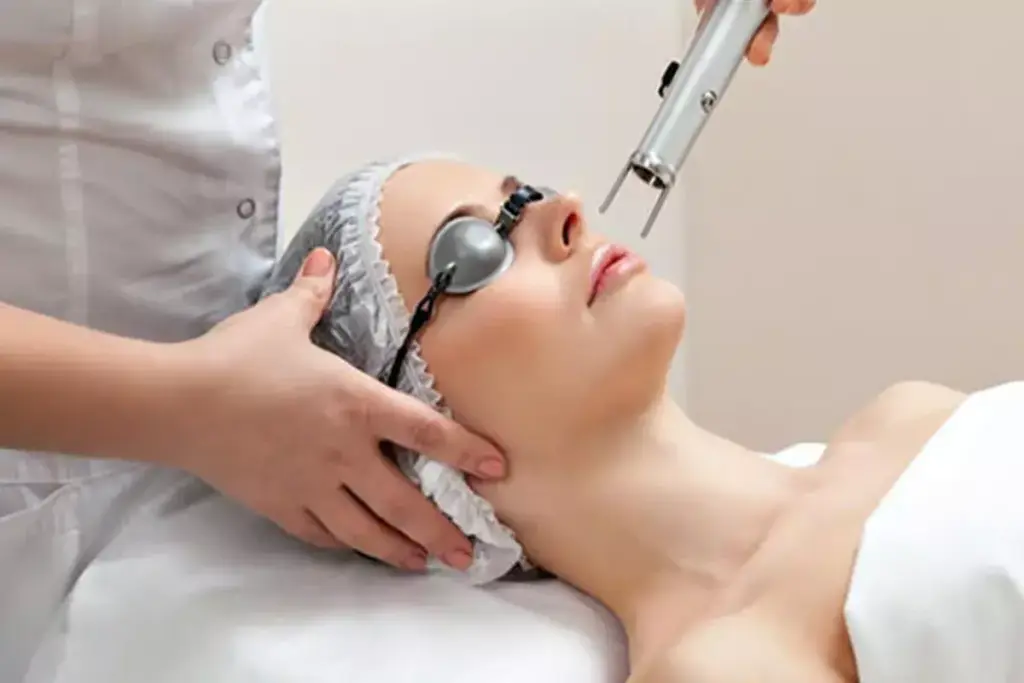 How to Remove Face Wrinkles with Laser Treatment