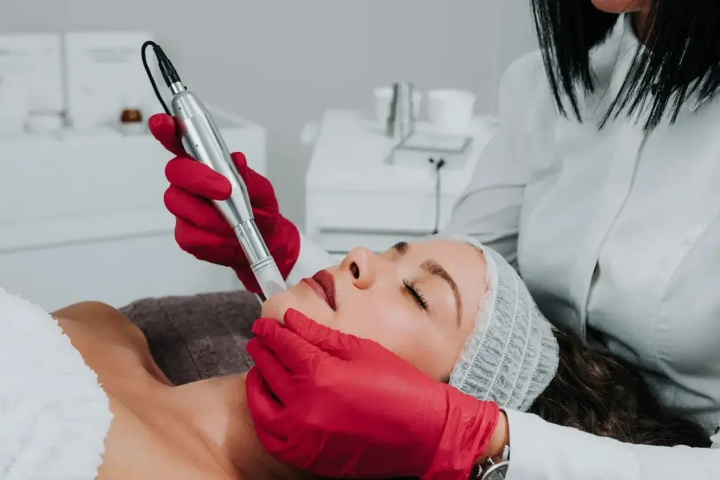 Complete What Works Better Than Microneedling (Fractional Laser Resurfacing)?