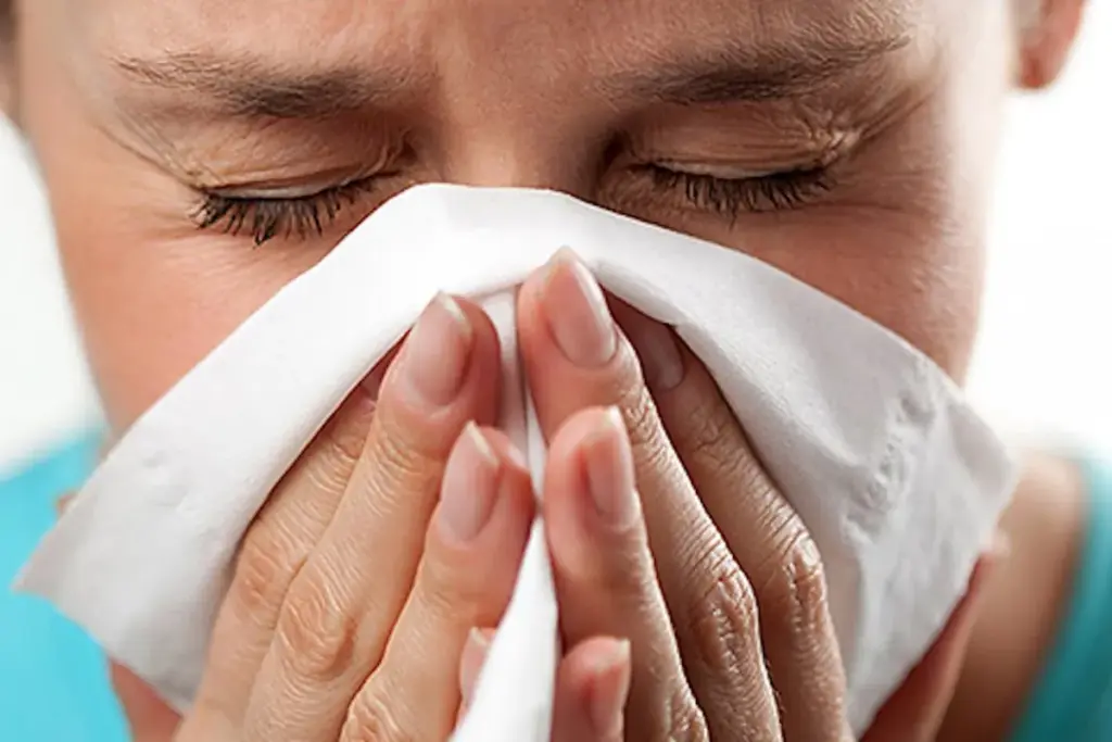 Guide Difference Between Rhinitis And Sinusitis (Rhinitis Vs Sinusitis)