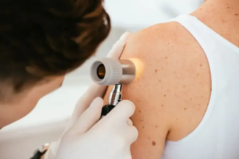 Do Dermatologists Use A Dermascope For Skin In Genital Area