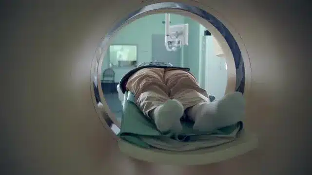 How Long Does an MRI Take: Result Tips