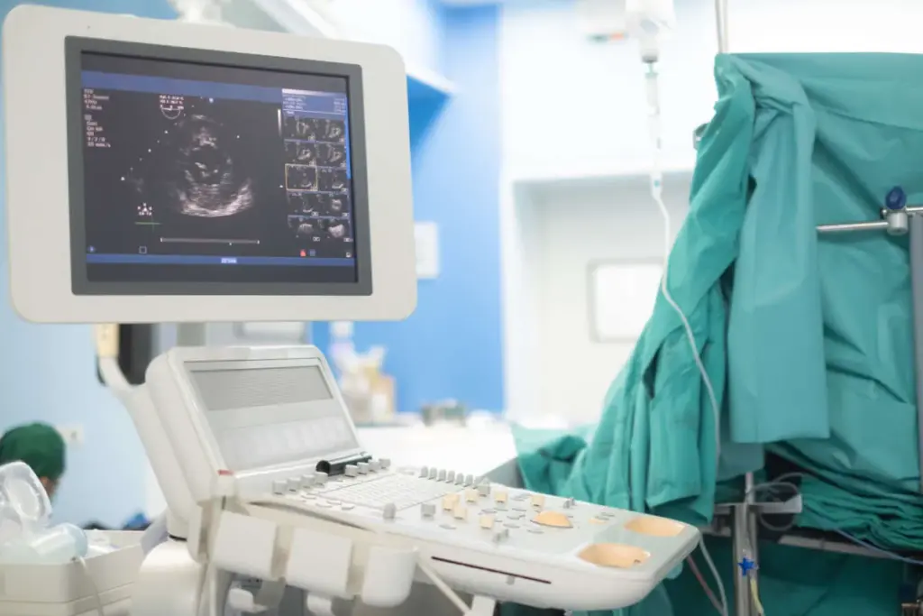 Pericardial Effusion: Best Normal Stats