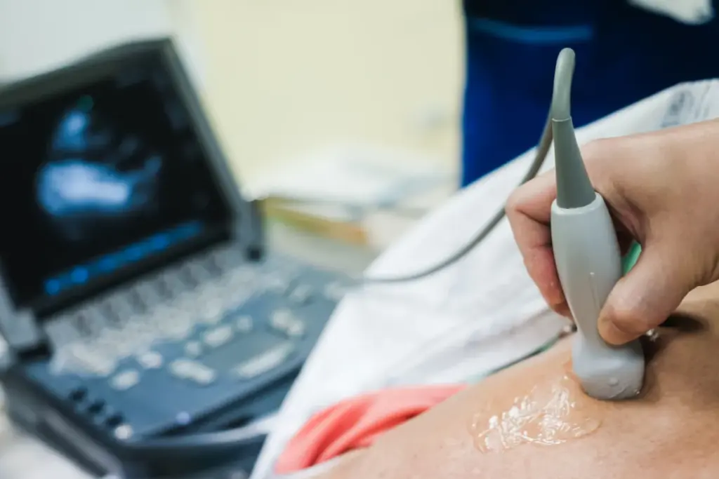 What Does an Echocardiogram Show: Colors