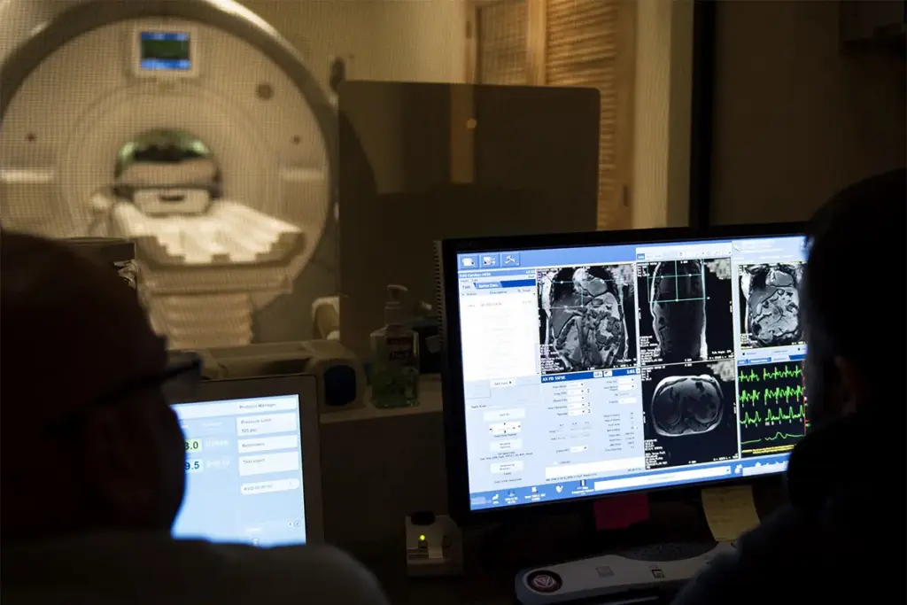 MRI Cardiovascular: Best Imaging Types