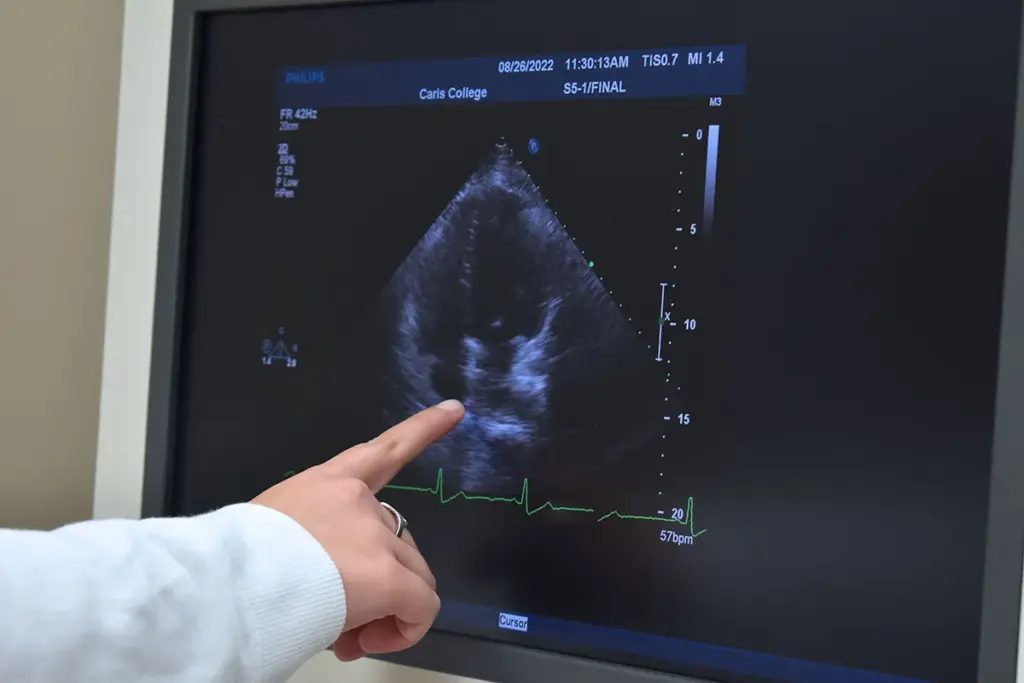 How Long For CT Scan Results: Best Guide