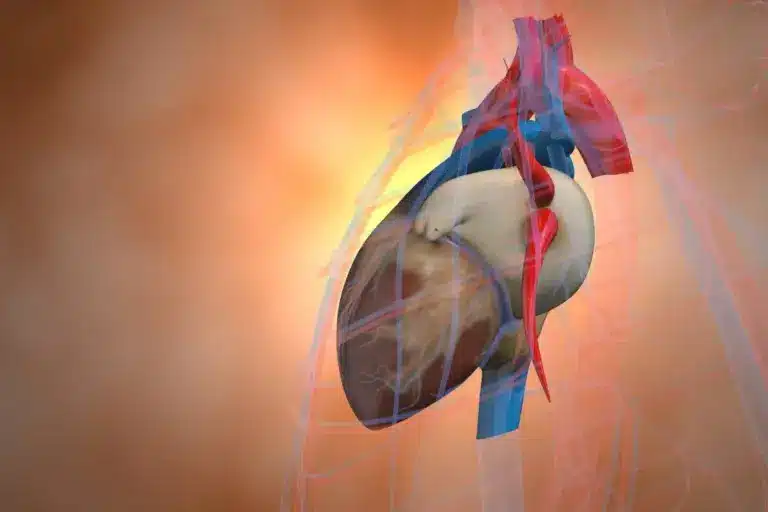 4 Stages Ischemic Heart Disease: Critical Guide