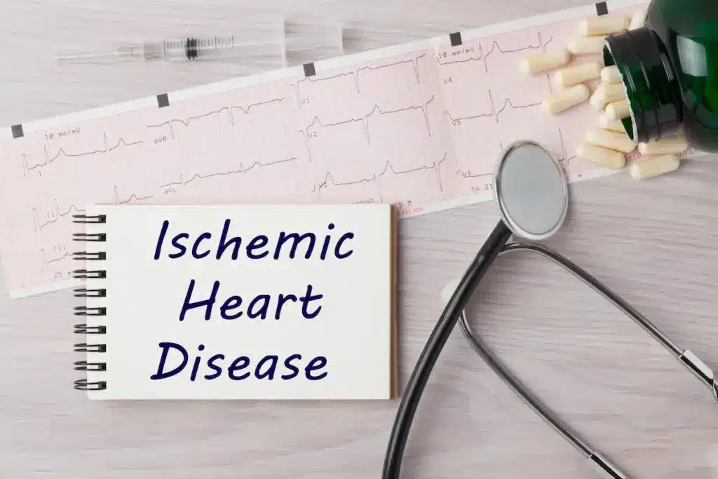 Most Common Cause Ischemic Heart Disease Info